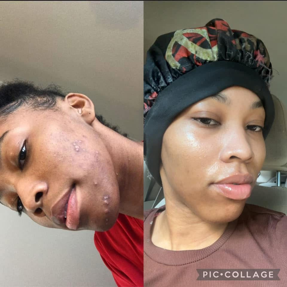 Rosemary Glo Serum