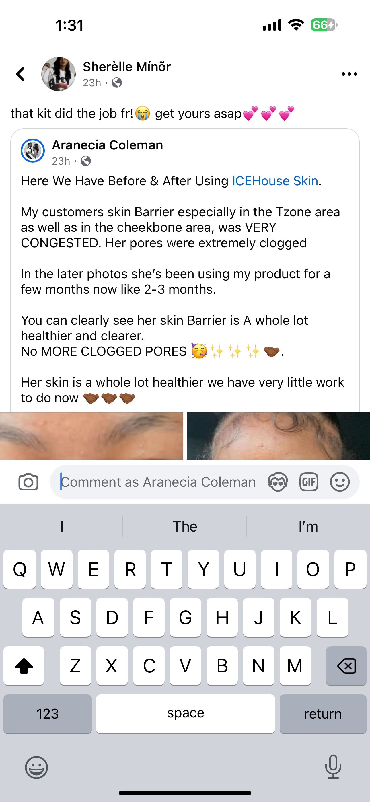 Bundle Kit